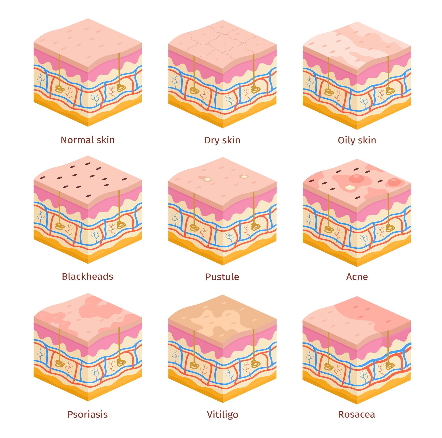 Skin, Hair & Allergy Conditions